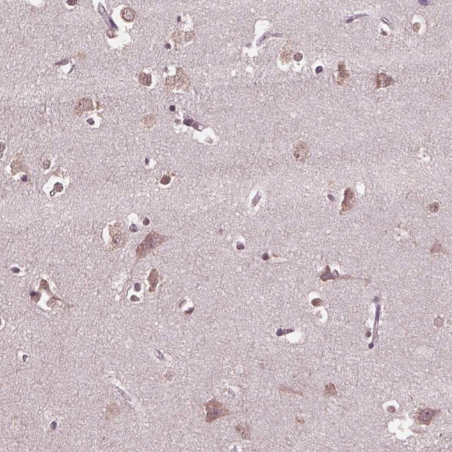 CPT1C Antibody in Immunohistochemistry (Paraffin) (IHC (P))