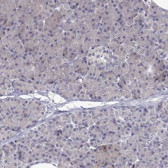 SULT2A1 Antibody in Immunohistochemistry (Paraffin) (IHC (P))