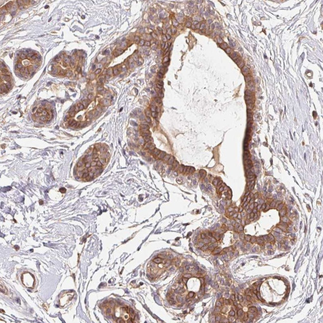 MAPKAPK2 Antibody in Immunohistochemistry (Paraffin) (IHC (P))