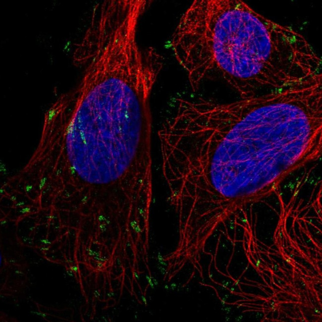 Vinculin Antibody in Immunocytochemistry (ICC/IF)