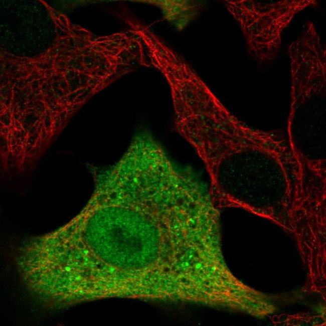 ALDH3A1 Antibody in Immunocytochemistry (ICC/IF)