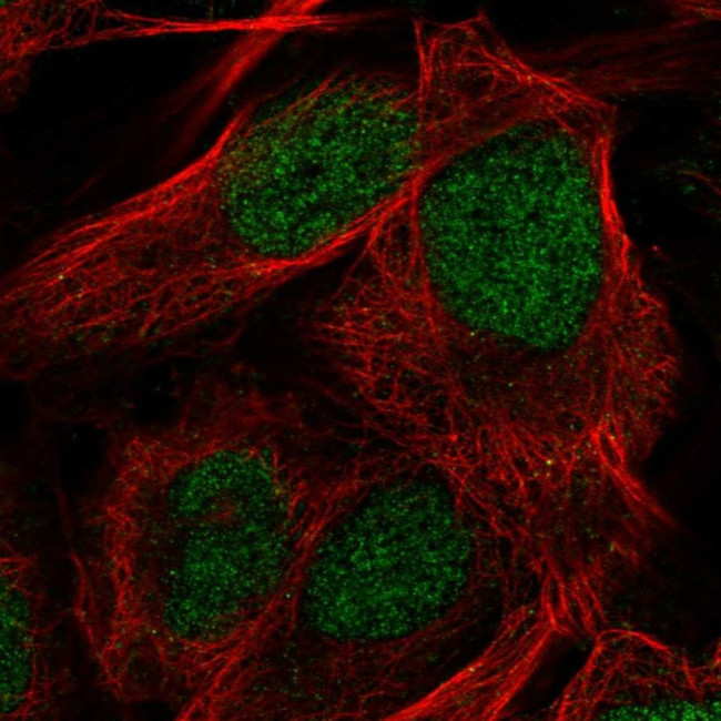 CDA Antibody in Immunocytochemistry (ICC/IF)