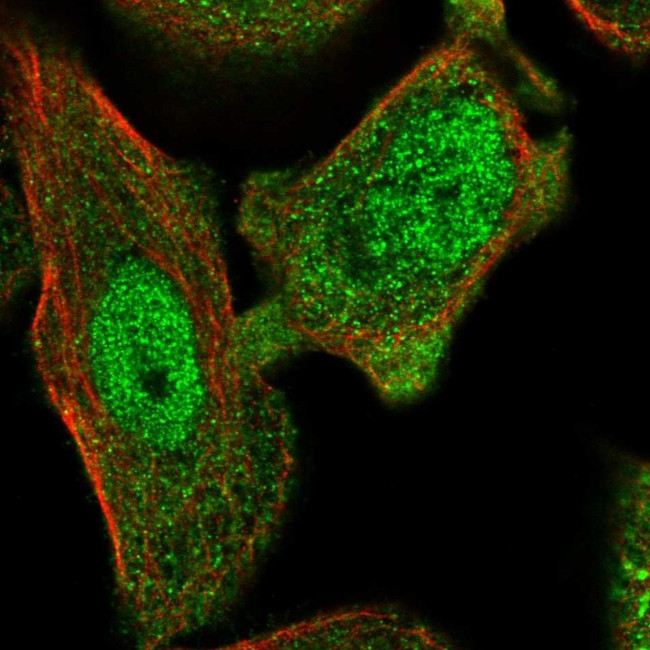 Annexin A7 Antibody in Immunocytochemistry (ICC/IF)