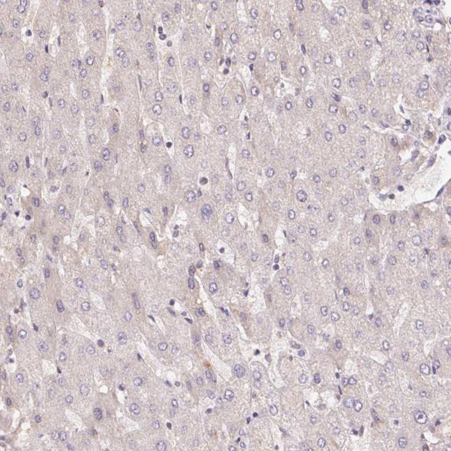 CENPF Antibody in Immunohistochemistry (Paraffin) (IHC (P))