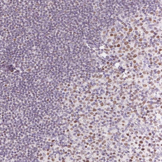 Oct-2 Antibody in Immunohistochemistry (Paraffin) (IHC (P))