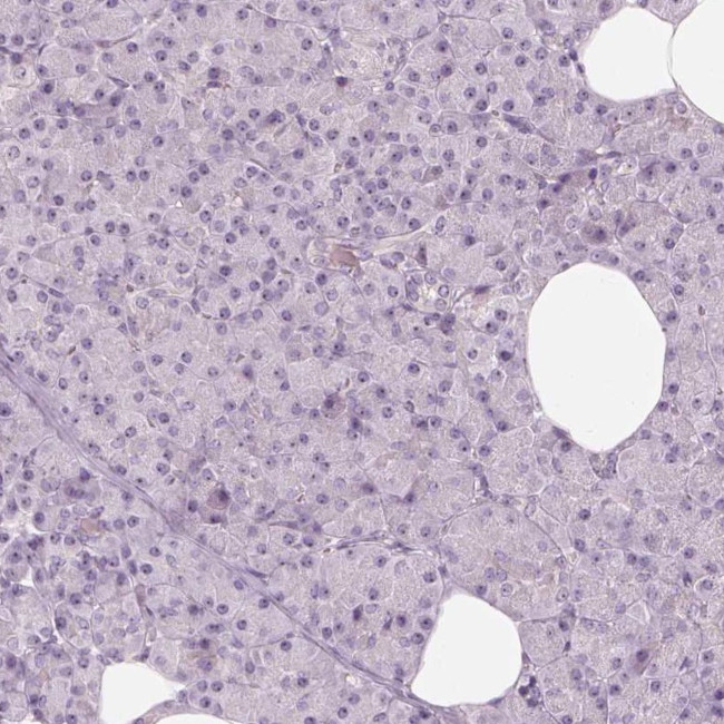 CDS1 Antibody in Immunohistochemistry (Paraffin) (IHC (P))