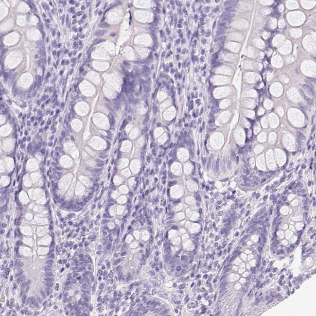 ATP6V0A4 Antibody in Immunohistochemistry (Paraffin) (IHC (P))