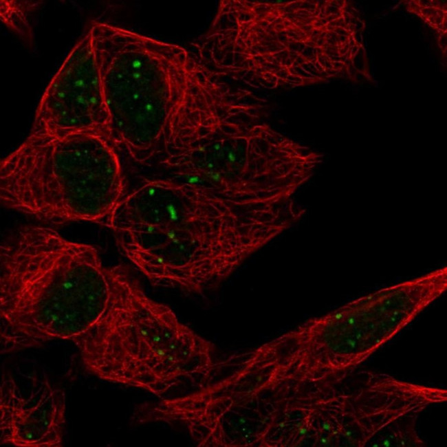 ATRX Antibody in Immunocytochemistry (ICC/IF)