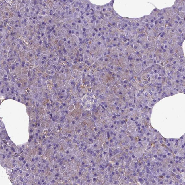 MVP Antibody in Immunohistochemistry (Paraffin) (IHC (P))