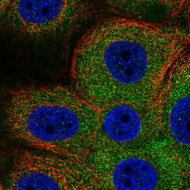 PHKG2 Antibody in Immunocytochemistry (ICC/IF)