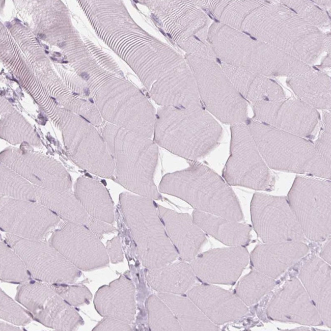 DNase II Antibody in Immunohistochemistry (Paraffin) (IHC (P))