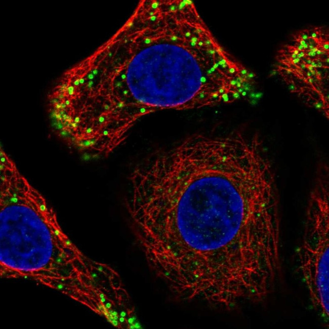 DULLARD Antibody in Immunocytochemistry (ICC/IF)