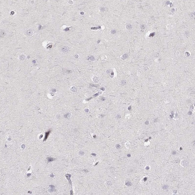 Neutrophil elastase Antibody in Immunohistochemistry (Paraffin) (IHC (P))