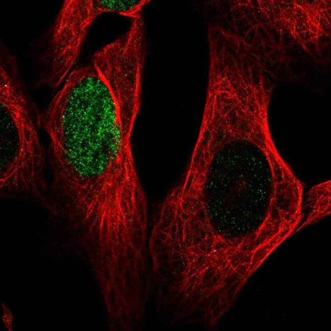 HES1 Antibody in Immunocytochemistry (ICC/IF)