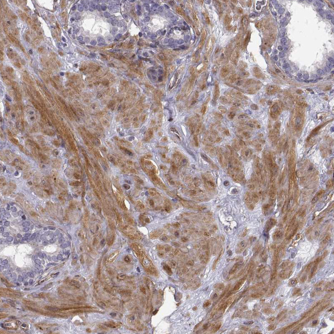 PGM5 Antibody in Immunohistochemistry (Paraffin) (IHC (P))