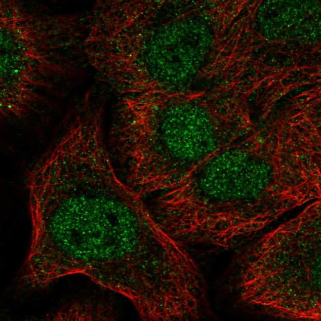 NOTCH1 Antibody in Immunocytochemistry (ICC/IF)