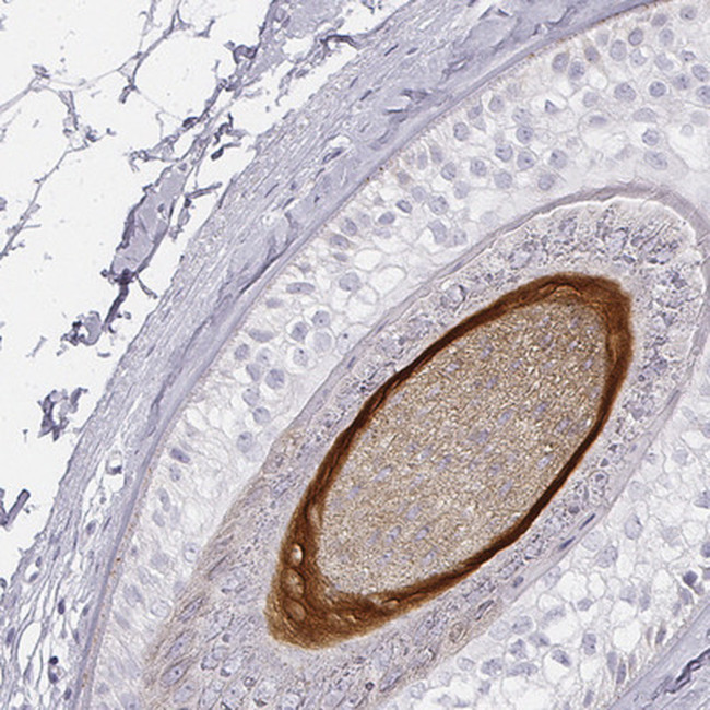 KRT82 Antibody in Immunohistochemistry (Paraffin) (IHC (P))