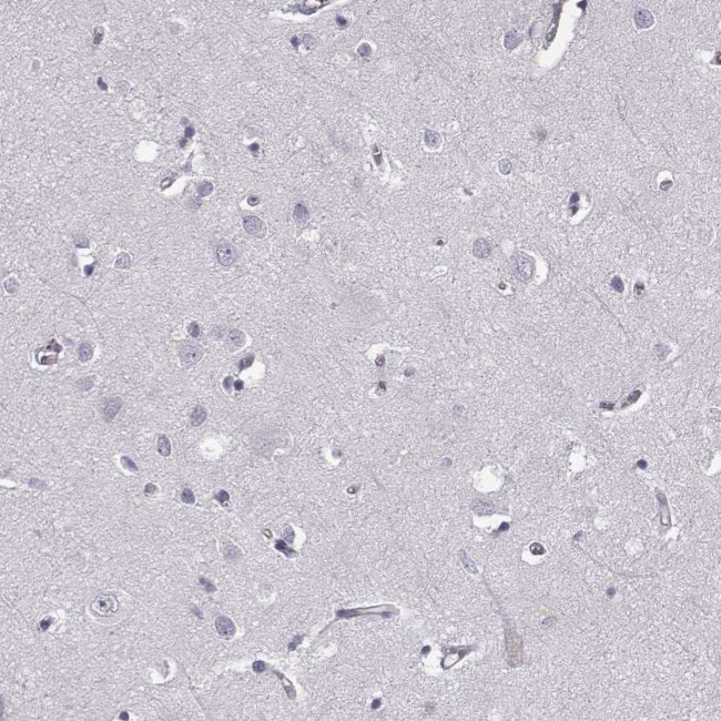 MIP-3 beta Antibody in Immunohistochemistry (Paraffin) (IHC (P))