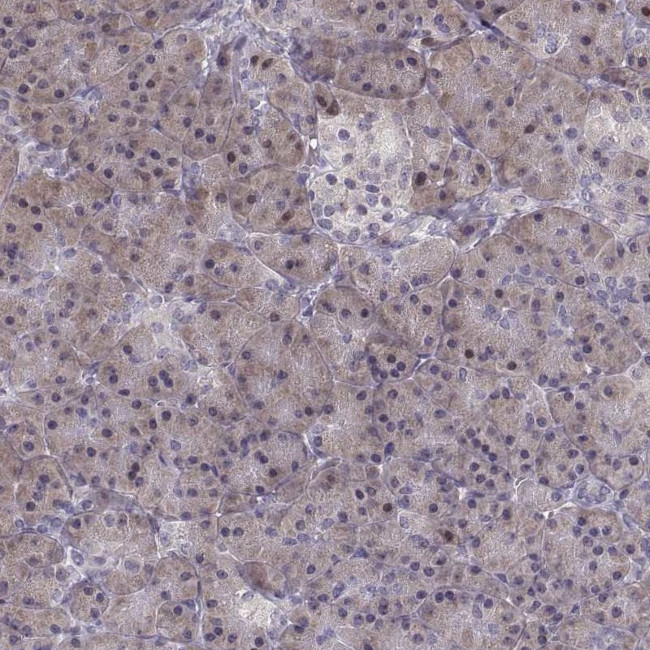 ADH6 Antibody in Immunohistochemistry (Paraffin) (IHC (P))