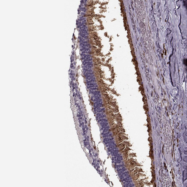 CACNA1F Antibody in Immunohistochemistry (Paraffin) (IHC (P))