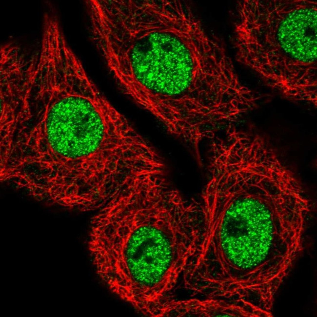 MED25 Antibody in Immunocytochemistry (ICC/IF)