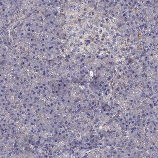 ITGB1 Antibody in Immunohistochemistry (Paraffin) (IHC (P))