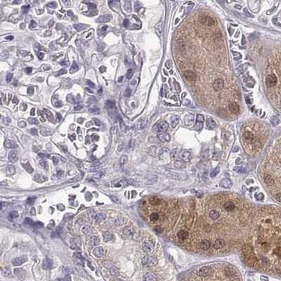 ADH6 Antibody in Immunohistochemistry (Paraffin) (IHC (P))