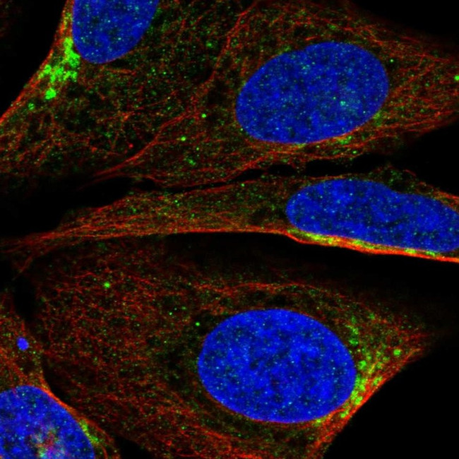 PIK3R2 Antibody in Immunocytochemistry (ICC/IF)