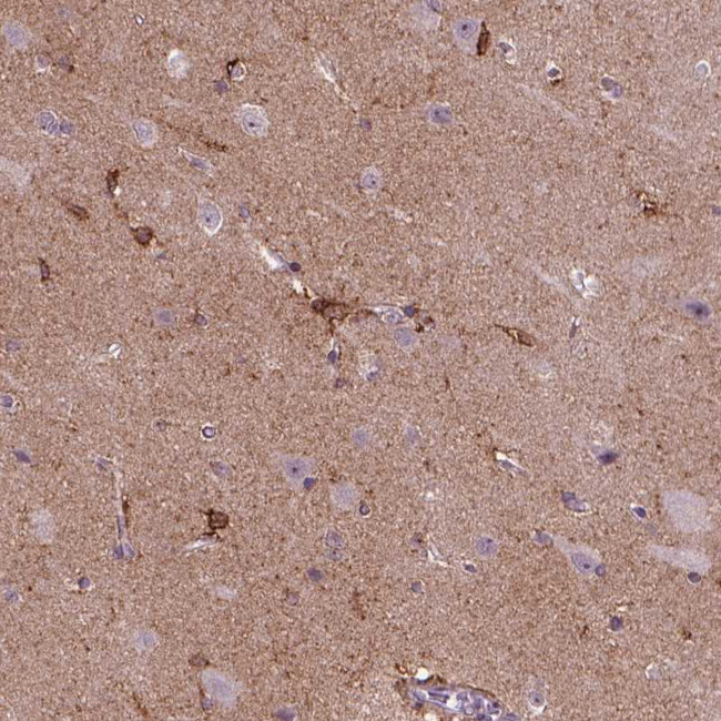 MARCKS Antibody in Immunohistochemistry (Paraffin) (IHC (P))