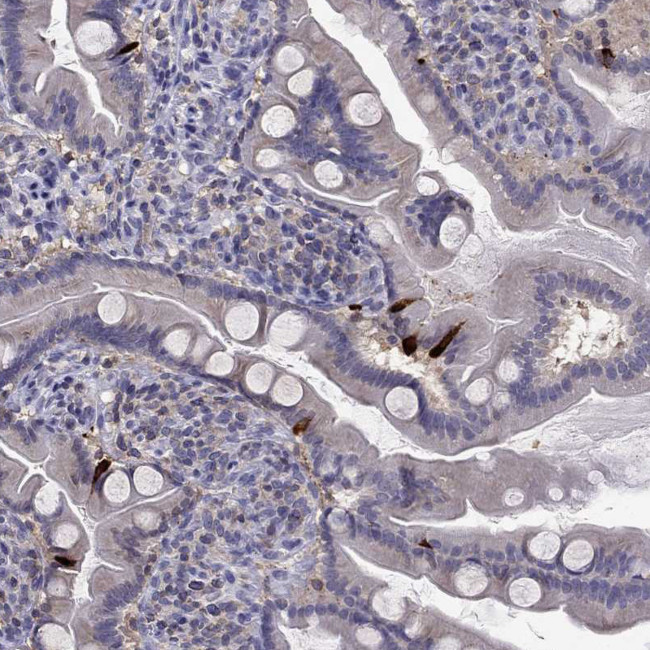 CCK Antibody in Immunohistochemistry (Paraffin) (IHC (P))