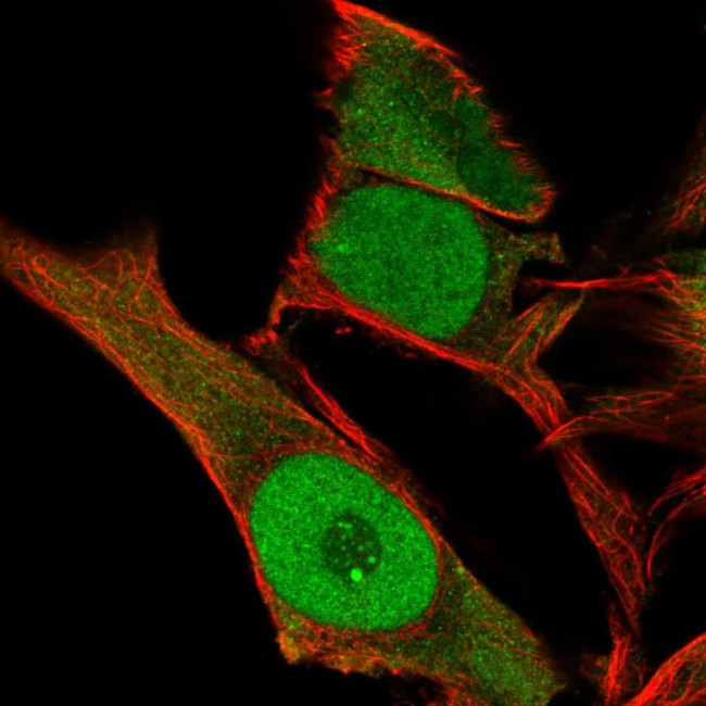 KLF6 Antibody in Immunocytochemistry (ICC/IF)