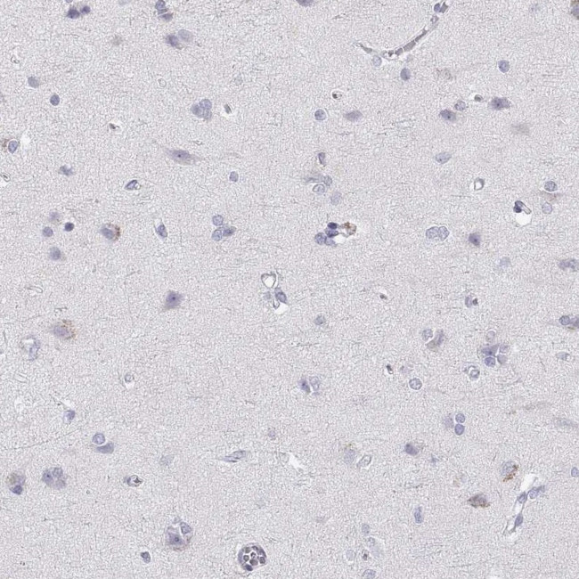 RGS19 Antibody in Immunohistochemistry (Paraffin) (IHC (P))