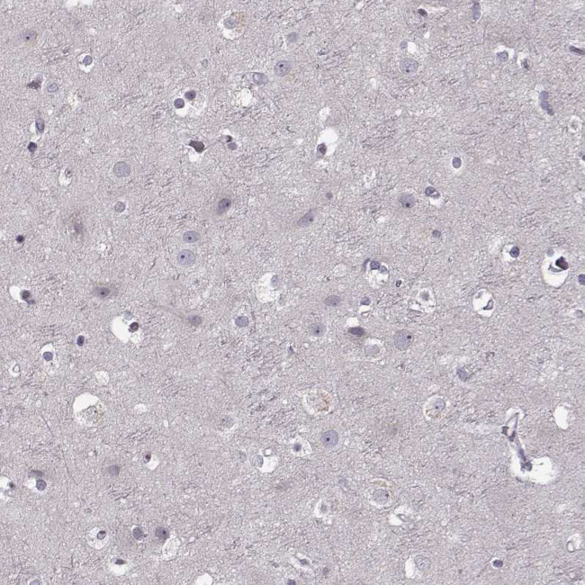 CD28 Antibody in Immunohistochemistry (Paraffin) (IHC (P))