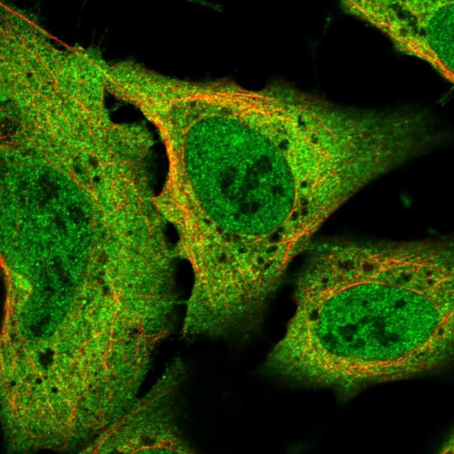 SLC8A1 Antibody in Immunocytochemistry (ICC/IF)