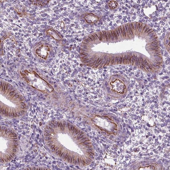 ACER3 Antibody in Immunohistochemistry (Paraffin) (IHC (P))