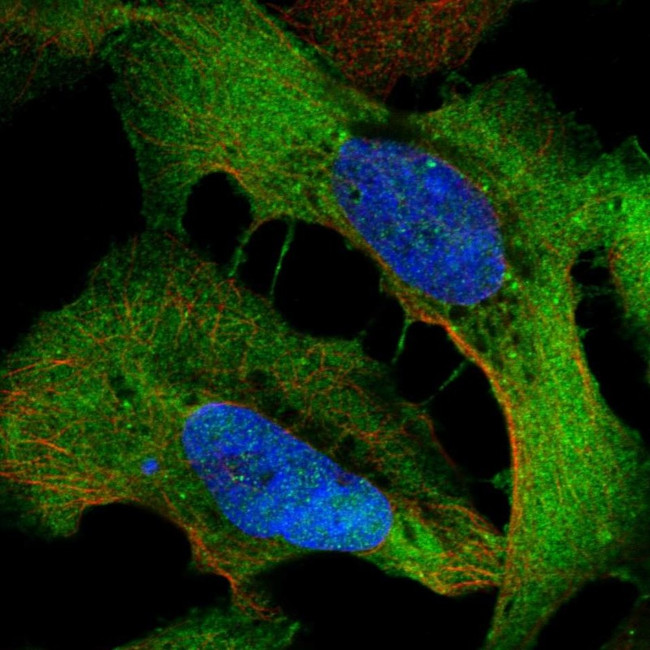 WDR1 Antibody in Immunocytochemistry (ICC/IF)