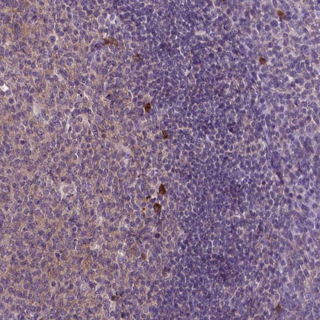 JAK3 Antibody in Immunohistochemistry (Paraffin) (IHC (P))