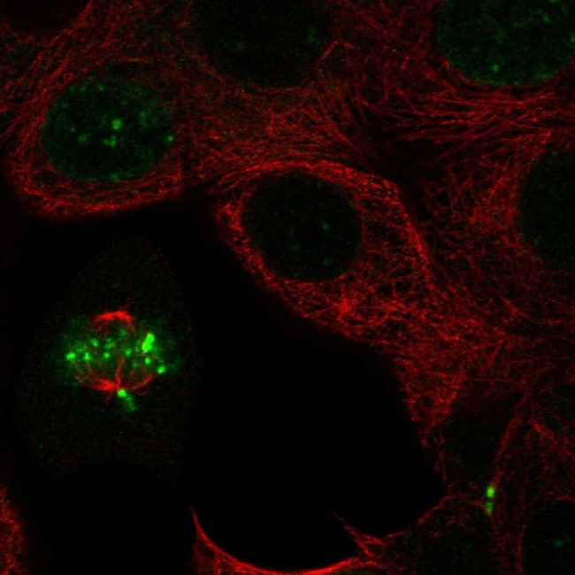 INCENP Antibody in Immunocytochemistry (ICC/IF)