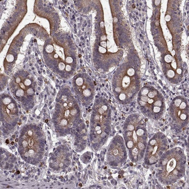 DENND4B Antibody in Immunohistochemistry (Paraffin) (IHC (P))