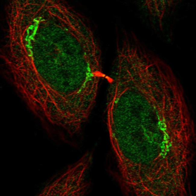 UHMK1 Antibody in Immunocytochemistry (ICC/IF)