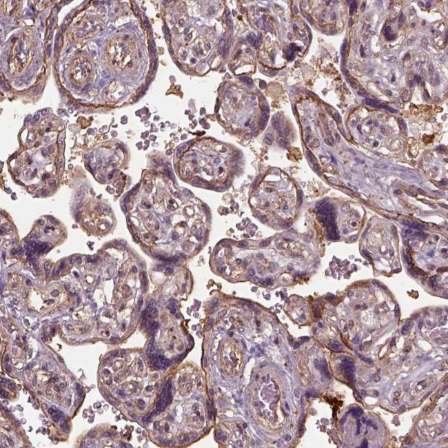 LIN7A Antibody in Immunohistochemistry (Paraffin) (IHC (P))