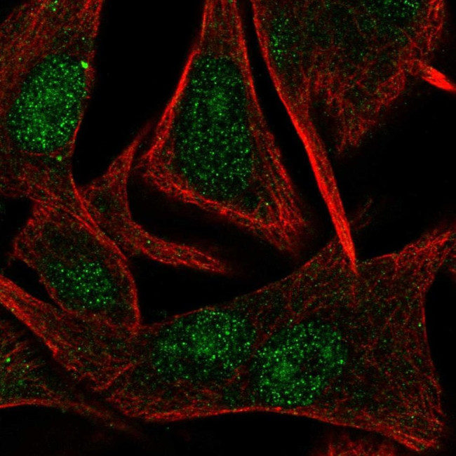 TBPL1 Antibody in Immunocytochemistry (ICC/IF)