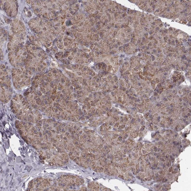 NDUFA7 Antibody in Immunohistochemistry (Paraffin) (IHC (P))