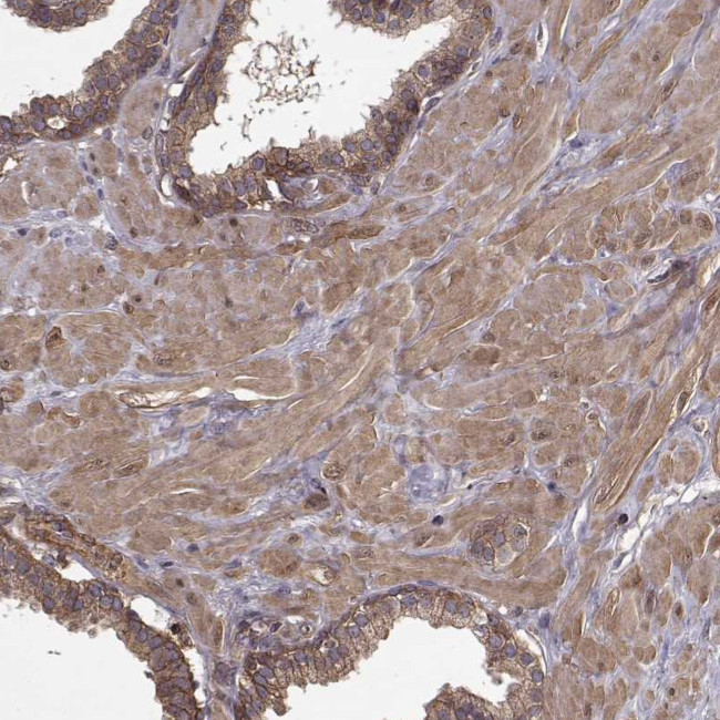 MYPT1 Antibody in Immunohistochemistry (Paraffin) (IHC (P))