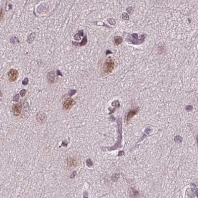 RCOR3 Antibody in Immunohistochemistry (Paraffin) (IHC (P))