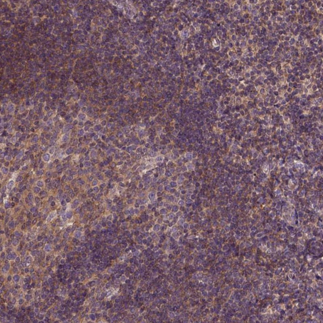 CPNE1 Antibody in Immunohistochemistry (Paraffin) (IHC (P))