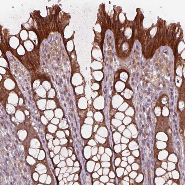 CHMP3 Antibody in Immunohistochemistry (Paraffin) (IHC (P))