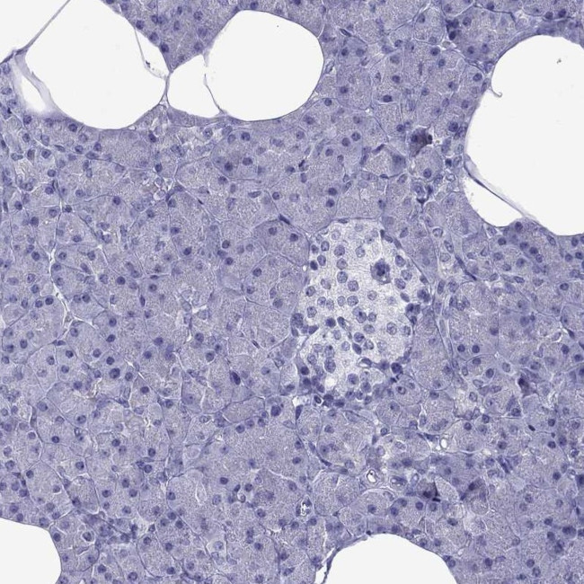 MLCK Antibody in Immunohistochemistry (Paraffin) (IHC (P))