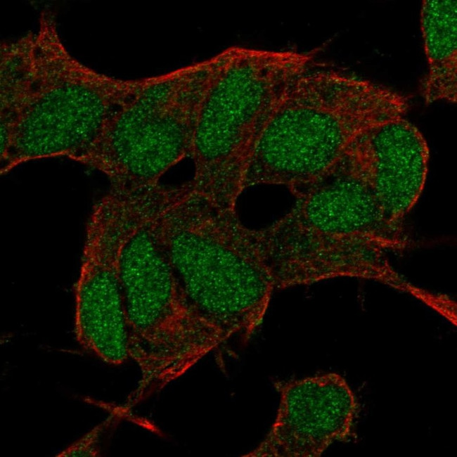 BCOR Antibody in Immunocytochemistry (ICC/IF)