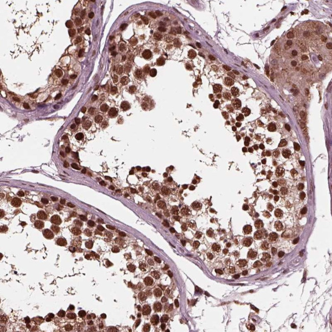 NSD1 Antibody in Immunohistochemistry (Paraffin) (IHC (P))